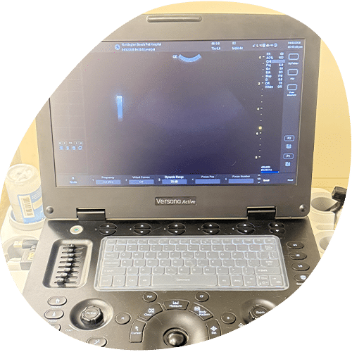 Versana Active ultrasound machine with screen and keyboard