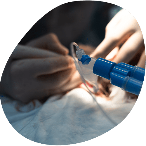 Dental procedure using blue surgical instrument on patient