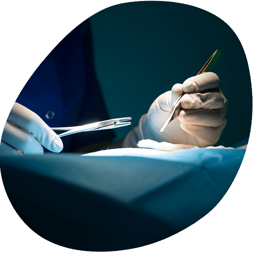 Surgeon's hands performing medical procedure with surgical instruments